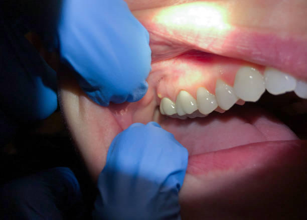 Best Emergency Dentist Near Me  in Johnsburg, IL