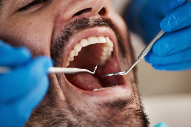 Best Tooth Infection Emergency Dentist  in Johnsburg, IL